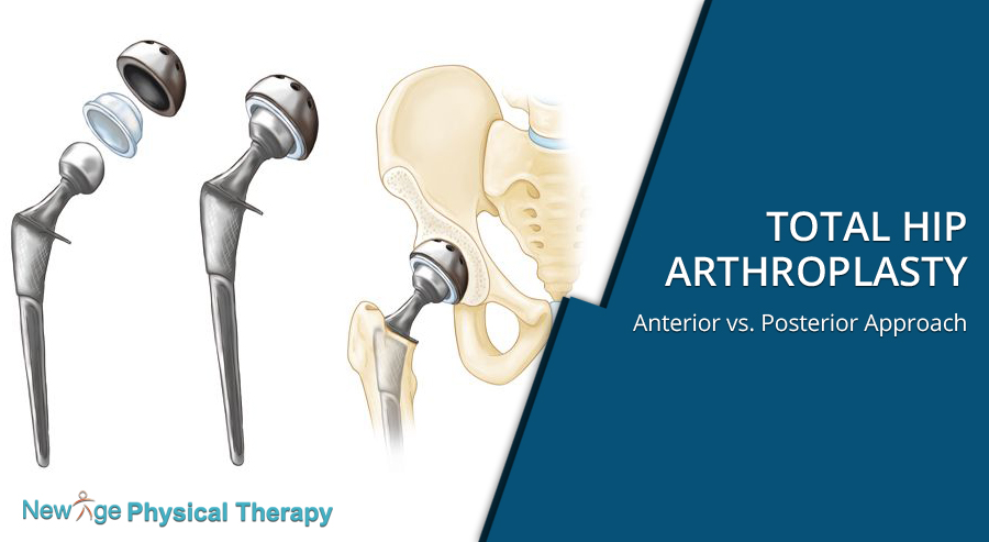 Physical Therapy For Hip Replacement Surgery Oasis Home Health Care